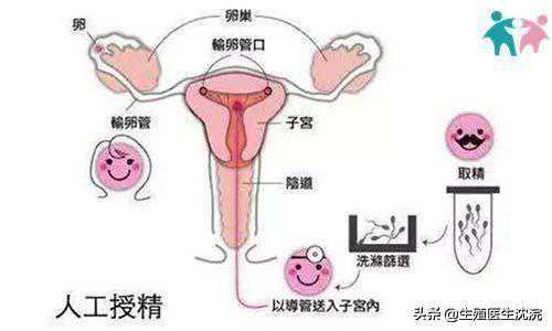 香港验血男女抽血需空腹吗,人工授精和试管婴儿并不是一回事?想要生孩子,备孕