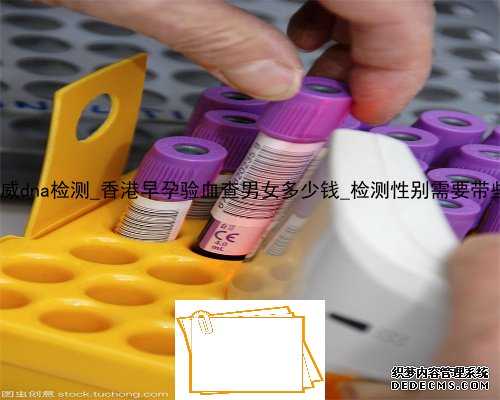 香港妇贝权威dna检测_香港早孕验血查男女多少钱_检测性别需要带些什么资料