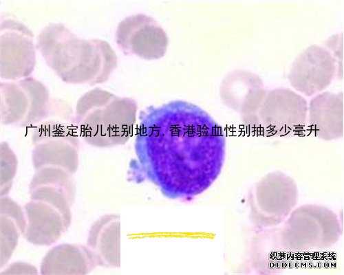 广州鉴定胎儿性别地方,香港验血性别抽多少毫升
