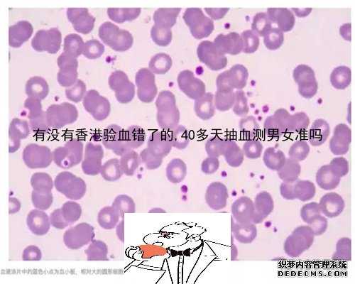 有没有香港验血错了的,40多天抽血测男女准吗